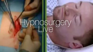 Hypnosurgery Live