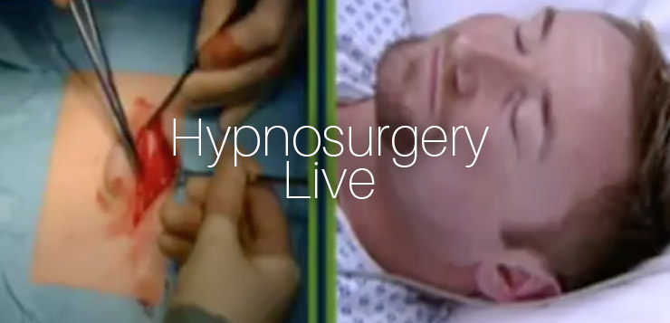 Hypnosurgery Live